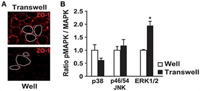 Bis-Retinoid A2E Induces an Increase of Basic Fibroblast Growth Factor via Inhibition of Extracellular Signal-Regulated Kinases 1/2 Pathway in Retinal Pigment Epithelium Cells and Facilitates Phagocytosis
